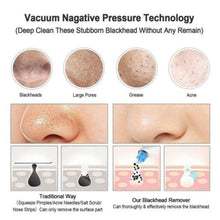 Load image into Gallery viewer, Hot Pro Vacuum Suction Blackhead Remover Nose Facial Pore Spot Cleaner Acne Black Head Pimple Remover Beauty Face Skin Care Tool