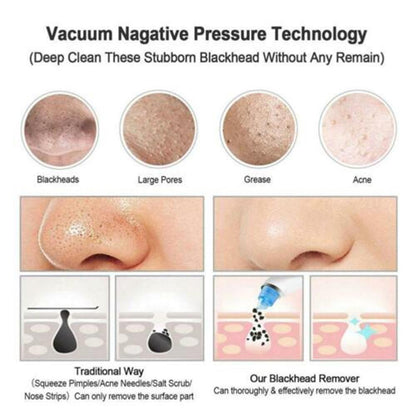 Hot Pro Vacuum Suction Blackhead Remover Nose Facial Pore Spot Cleaner Acne Black Head Pimple Remover Beauty Face Skin Care Tool