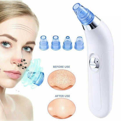 Hot Pro Vacuum Suction Blackhead Remover Nose Facial Pore Spot Cleaner Acne Black Head Pimple Remover Beauty Face Skin Care Tool